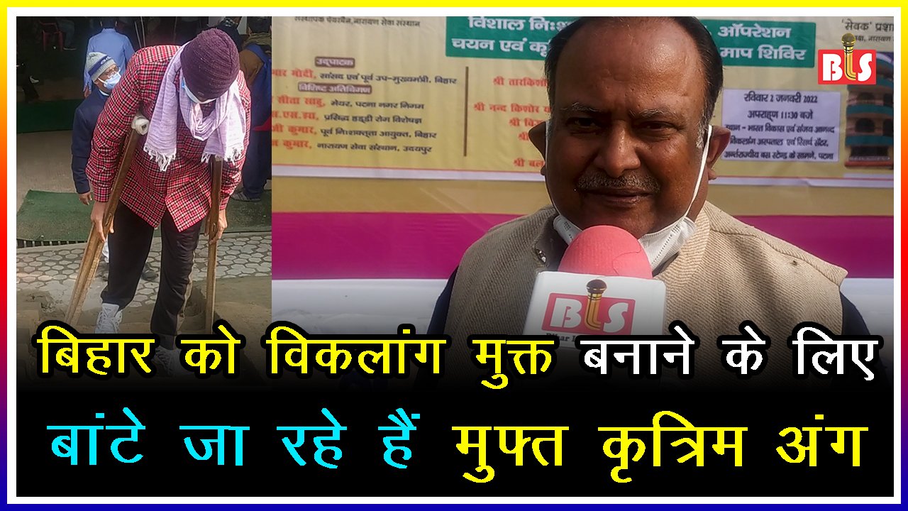 बिहार को विकलांग मुक्त बनाने के लिए बांटे जा रहे हैं मुफ्त कृत्रिम अंग